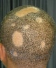 donald trump bald spot. donald trump bald. donald trump bald spot.